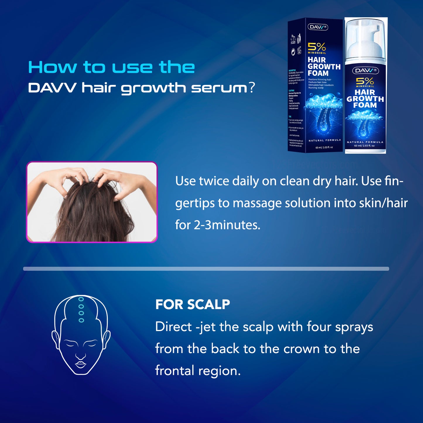 5% Minoxidil Hair Growth Foam For Men